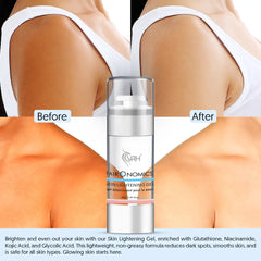 FLG 5 Skin Lightening Gel - 40 ml