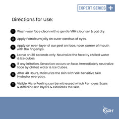 TCA Complex 35% 30ml | Professional Strength Trichloroacetic Acid Solution | Skin Resurfacing & Exfoliating Peel | Reduces Scars, Wrinkles & Pigmentation | For Advanced Peel Users