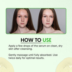 Acne Face Serum with 2% Salicylic + 10% Azelaic + 10% Niacinamide + Zinc | Reduces Stubborn Acne & Breakouts | Reduces Acne Marks & Dark Spot (30ml)