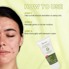 Acne Face Cleanser 75ml | with Adapinoid, Potassium Azeloyl Diglycinate & Encapsulated Salicylic Acid | For Clear, Balanced Skin | Gentle Cleanser for Acne-Prone Skin | Reduces Breakouts & Oiliness