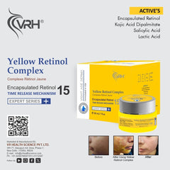 Yellow Retinol Complex 30ml | Encapsulated Retinol, Kojic Acid Dipalmitate, Salicylic Acid & Lactic Acid | Anti-Aging, Brightening & Exfoliating Serum | Reduces Fine Lines, Dark Spots & Uneven Texture